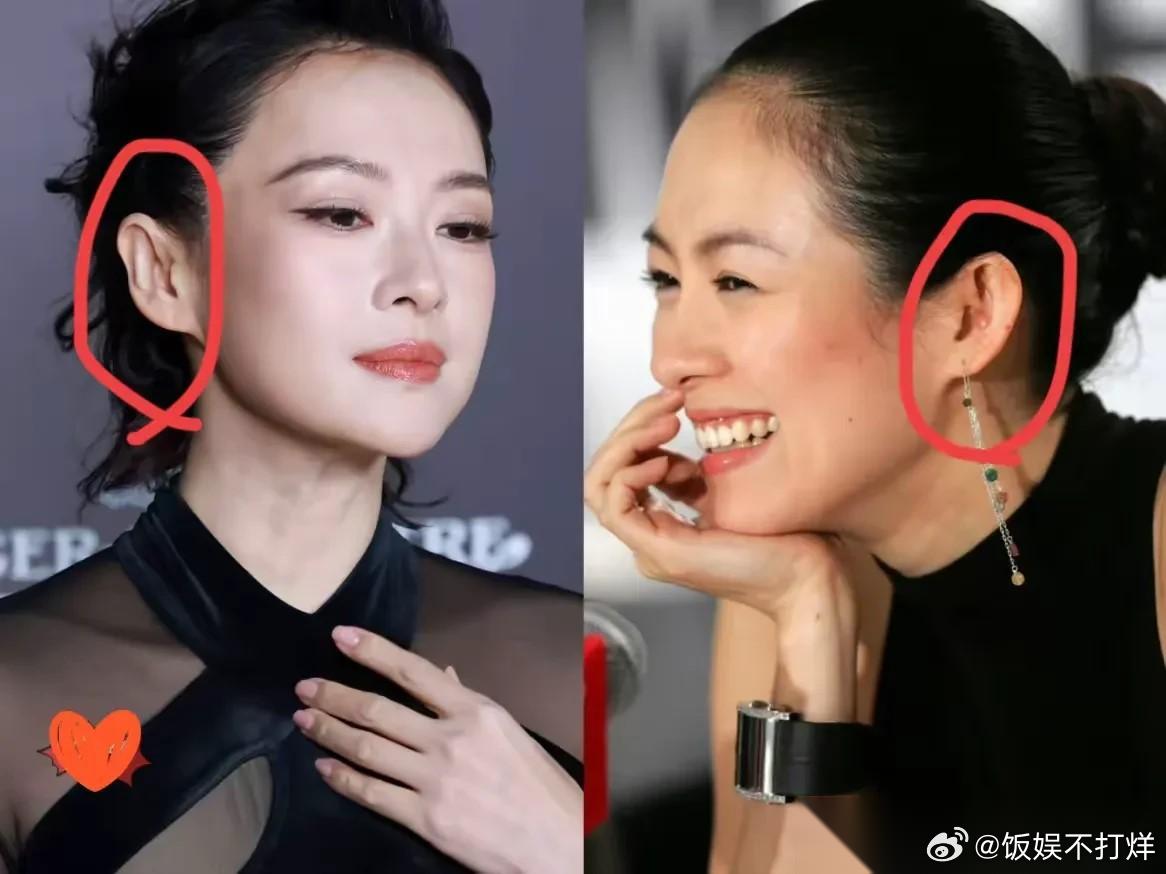 我问在医美机构的朋友， 章子怡是做了什么项目，耳朵的形状好像都变了。 朋友摇摇头