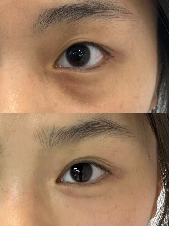 输就输在不会宣传…用过最牛bee的眼膜
