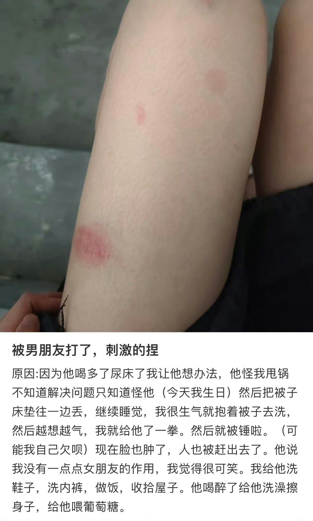 “被男朋友打了，很刺激” ​​​