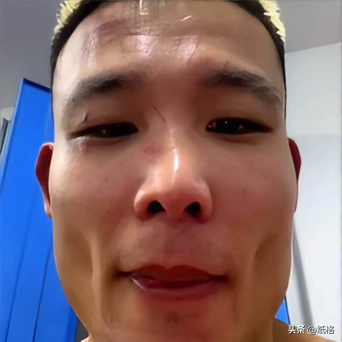 赵佳奇比赛被KO却多拿2000刀。
对手阿曼塔耶夫超重，谈好条件上台，对手被扣出