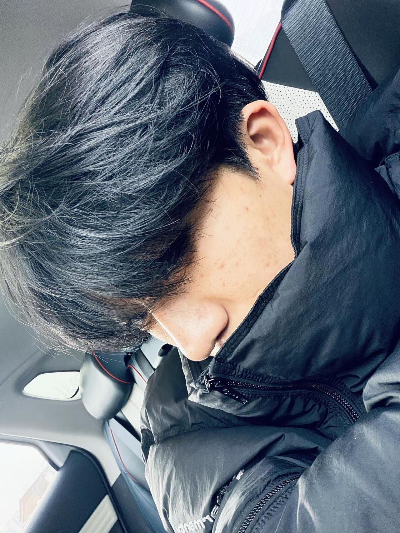 爱我痘印的脸和我拧巴的性格.