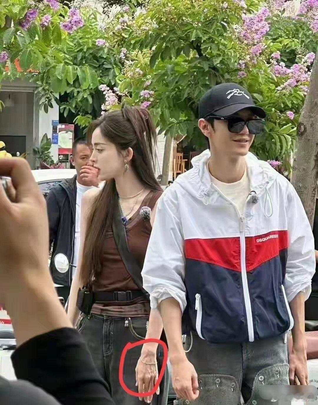 娜扎真的是太瘦了，经脉都和她戴的手链一样粗了！她这样的输液肯定特别方便吧[困] 