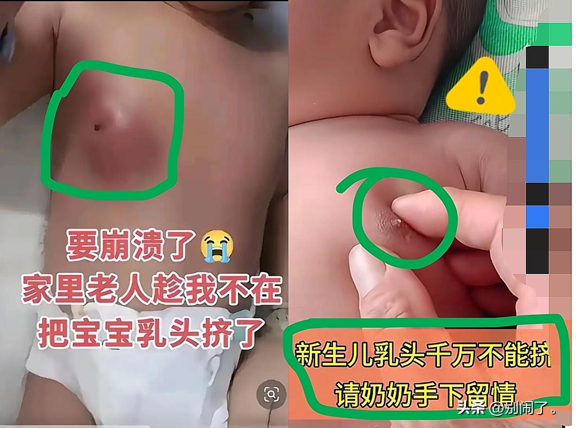 真的要气炸了
家里老人趁父母不在家
居然偷偷把刚出生宝宝的乳头给挤了，现在宝宝乳