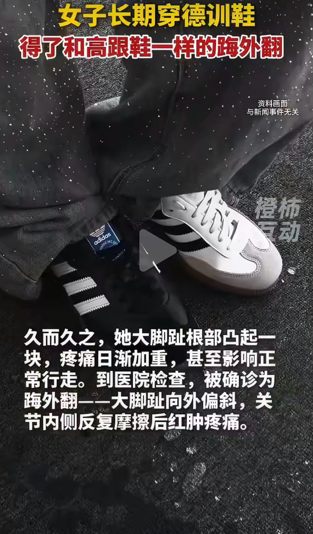 第一批穿德训鞋的受害者出现了和鞋没关系吧 啥鞋都会有人穿着不舒服 挑着合适自己的