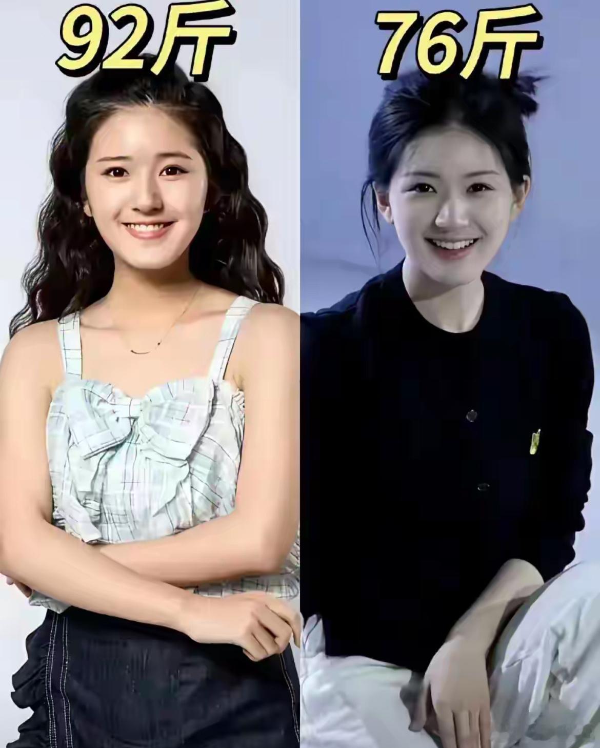 事实证明，婴儿肥比微整漂亮 