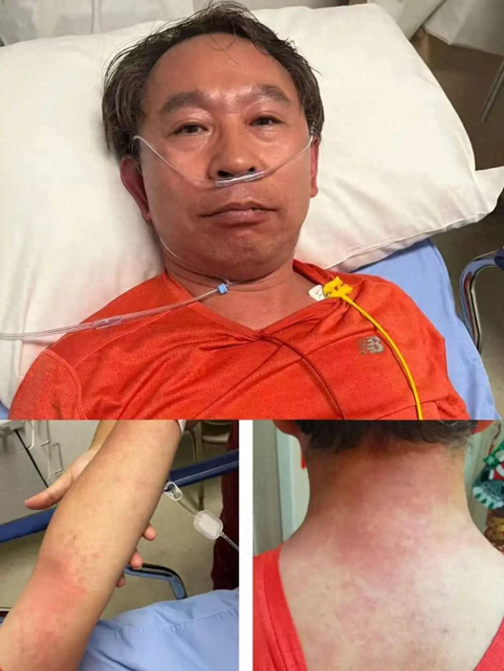 “万万没想到！”9月北京，协和医院的谭先杰教授感冒后吃了片头孢，几分钟后突然头痛