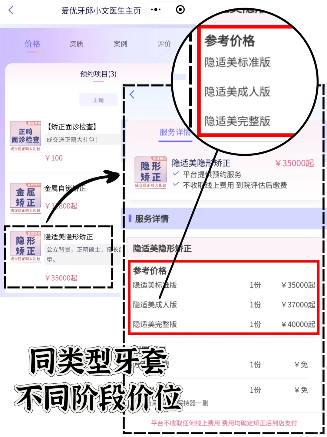 可别掉坑了⚠️长沙正畸注意隐形消费