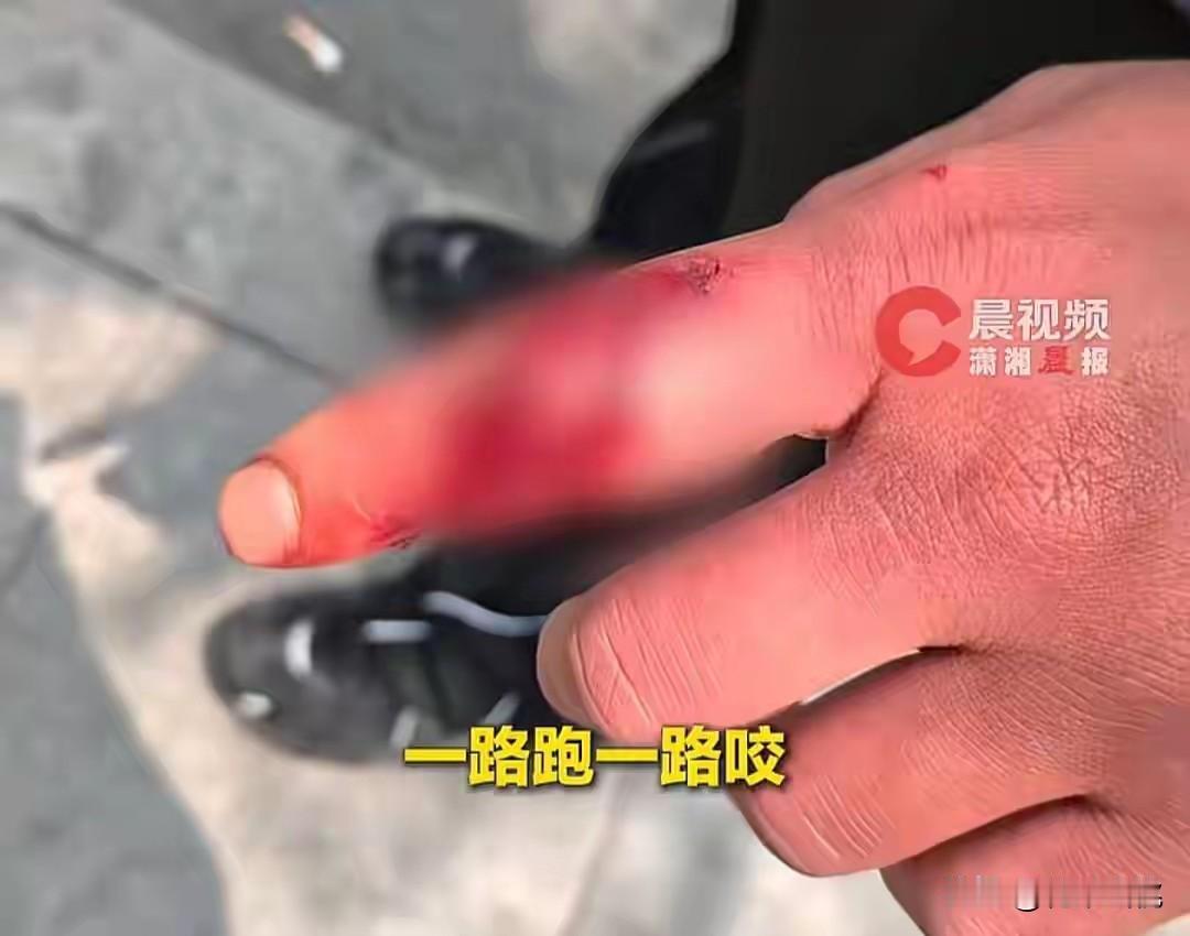 突发！杭州临平区内一只恶犬见人就咬，样子极其凶恶，已经有7个人被咬伤，城管组织搜