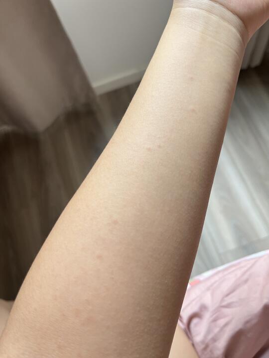 身上起红点点 一觉起来胳膊上起了好多小点点 不是很红也不痒 不知道咋了这是