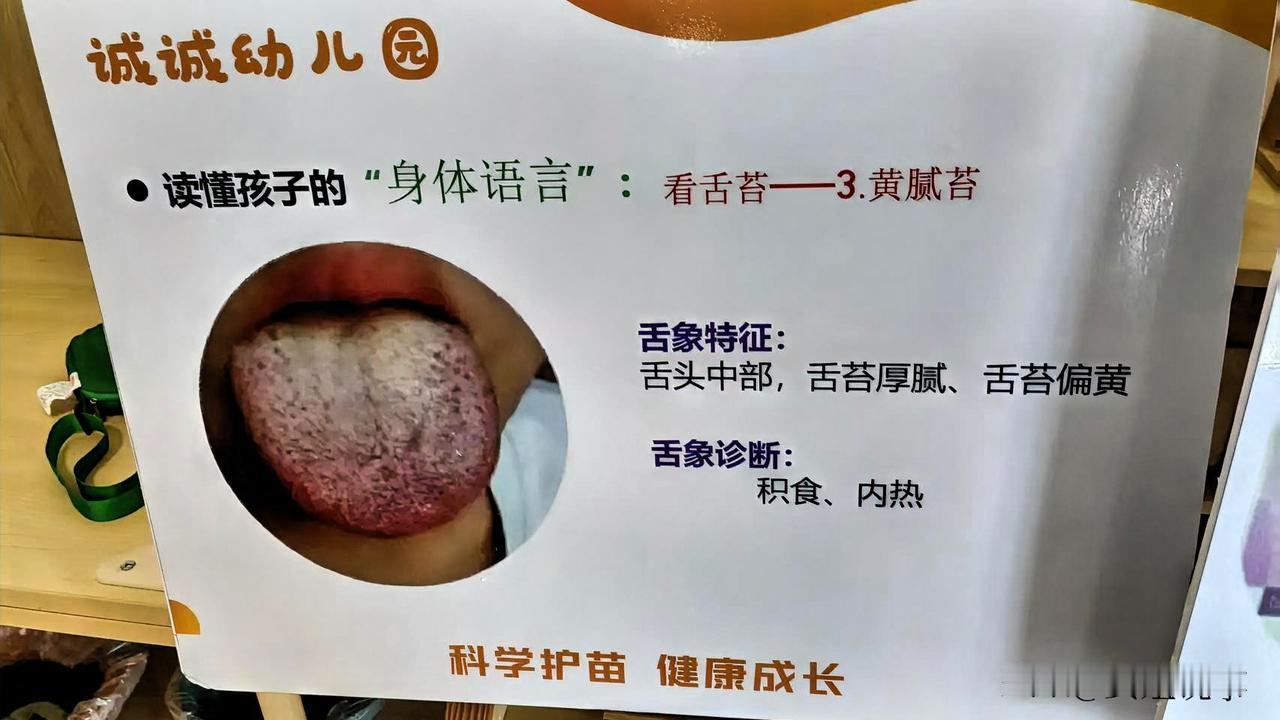 祖孙育儿闹分歧！孙子舌苔积食发黄，夜里总喊饿到底喂不喂？
 
今天陪着儿子、小孙
