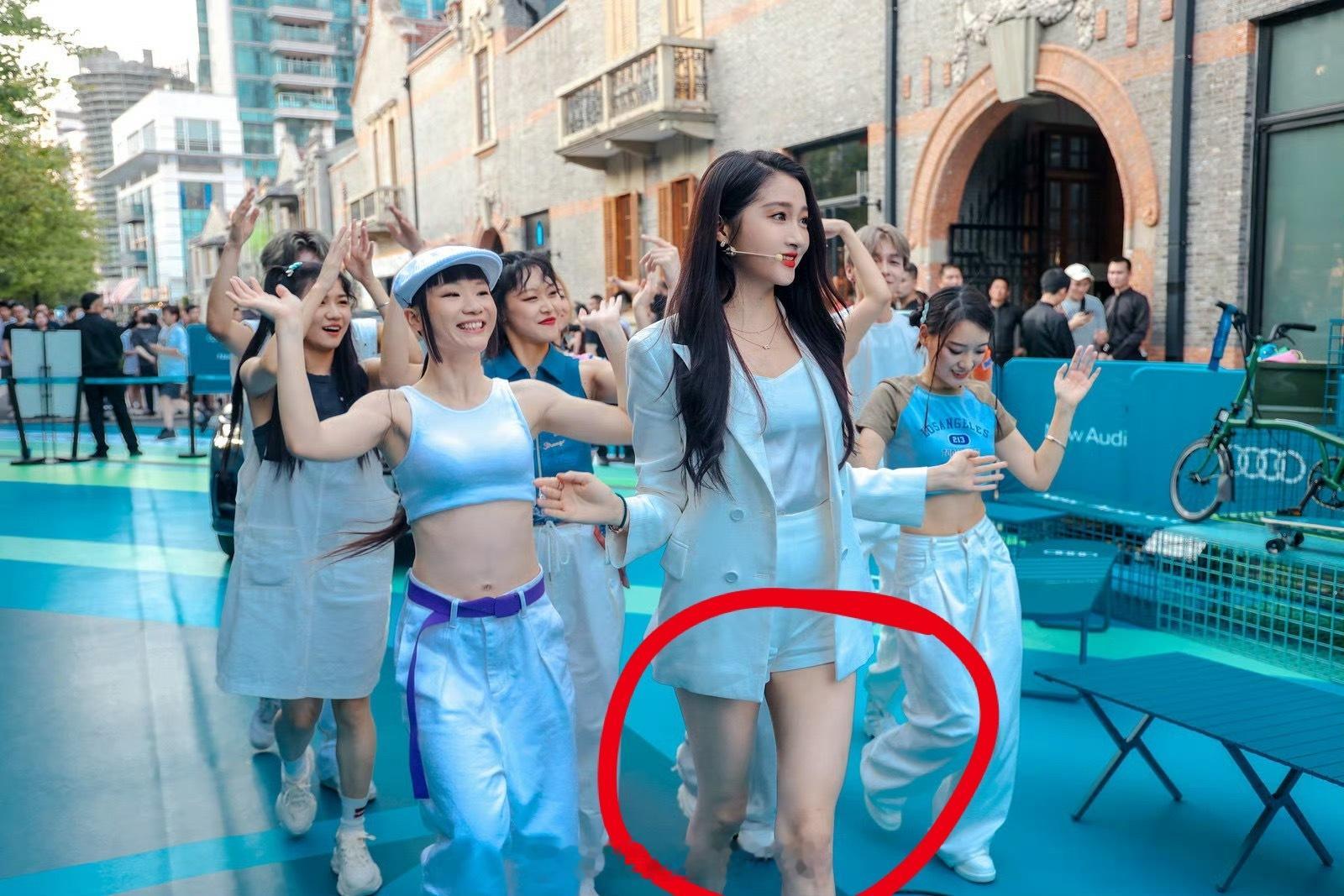 关晓彤奥迪汽车代言人 没别的意思，单纯好奇图1这个腿是什么情况[疑问][疑问][