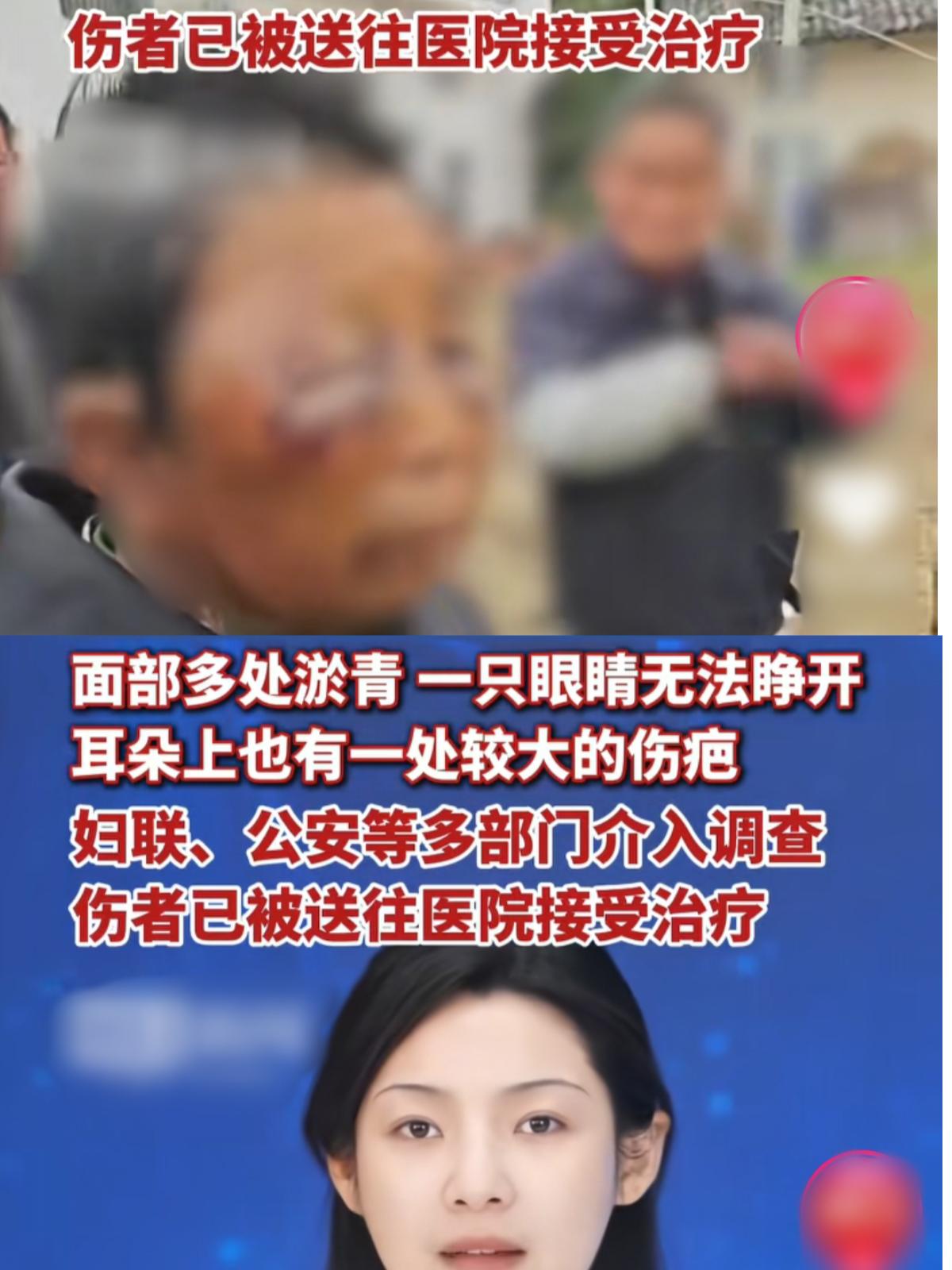 面对家暴绝不容忍，你的每一次容忍，就是让对方下次打的更狠。
不姑息，要反抗，第一