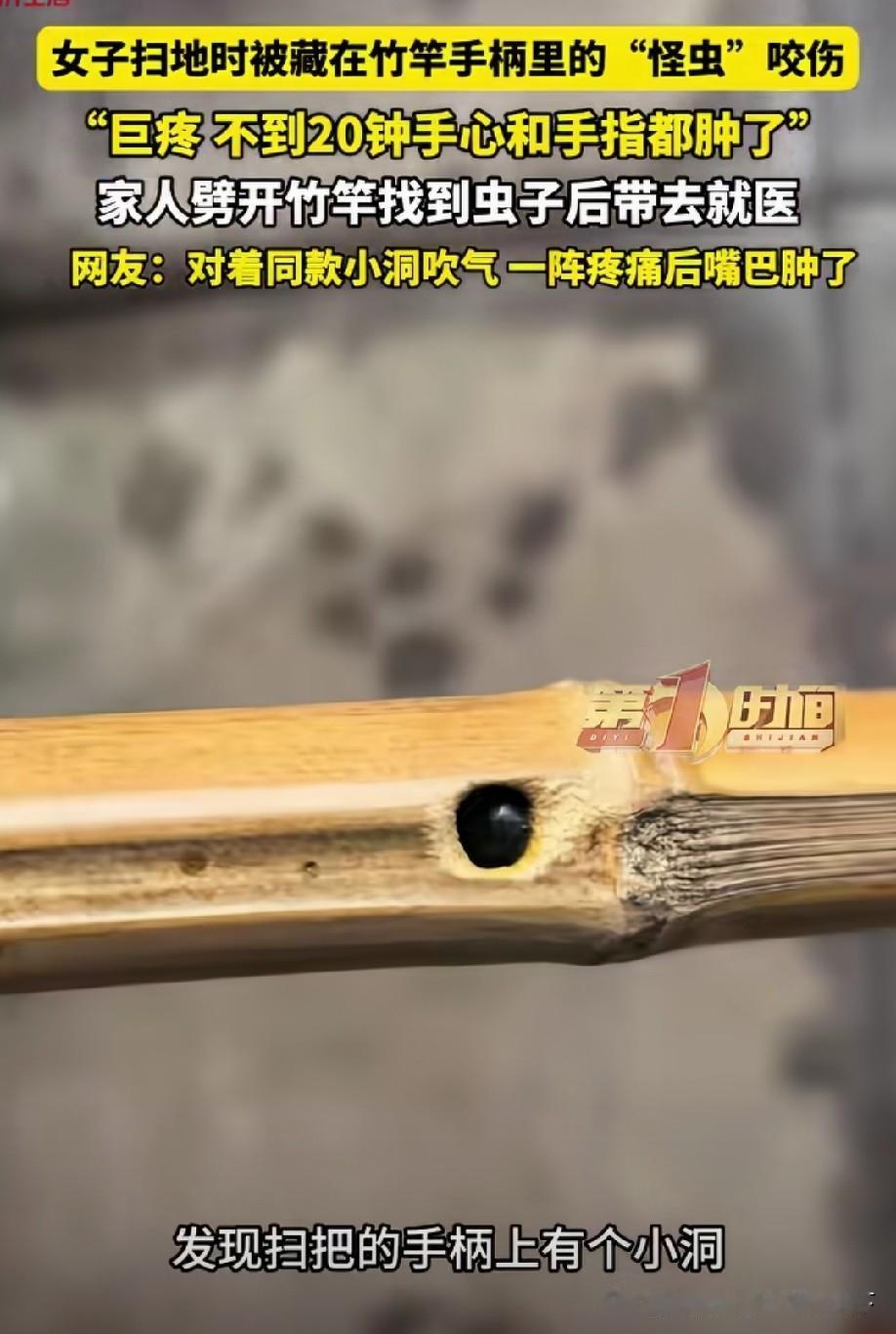 竹蜂，以前被咬过[泪奔]