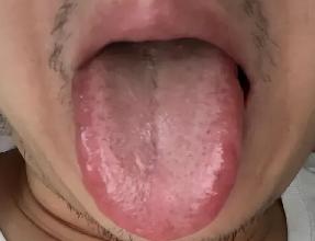 [呲牙]舌红为阴虚（有热）；舌胖为气虚（有湿）；舌白为血虚（有寒）。这几句话看似