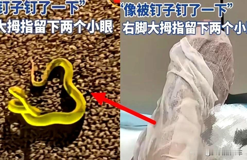 当然不是为了发朋友圈

遇到这种紧急情况还能冷静处理真的太关键了！

上次听说有