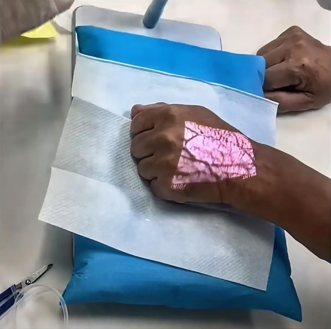 以前就有想过，如果血管能显影，打针就会解决很多医疗矛盾。想不到国产的静脉显像仪已