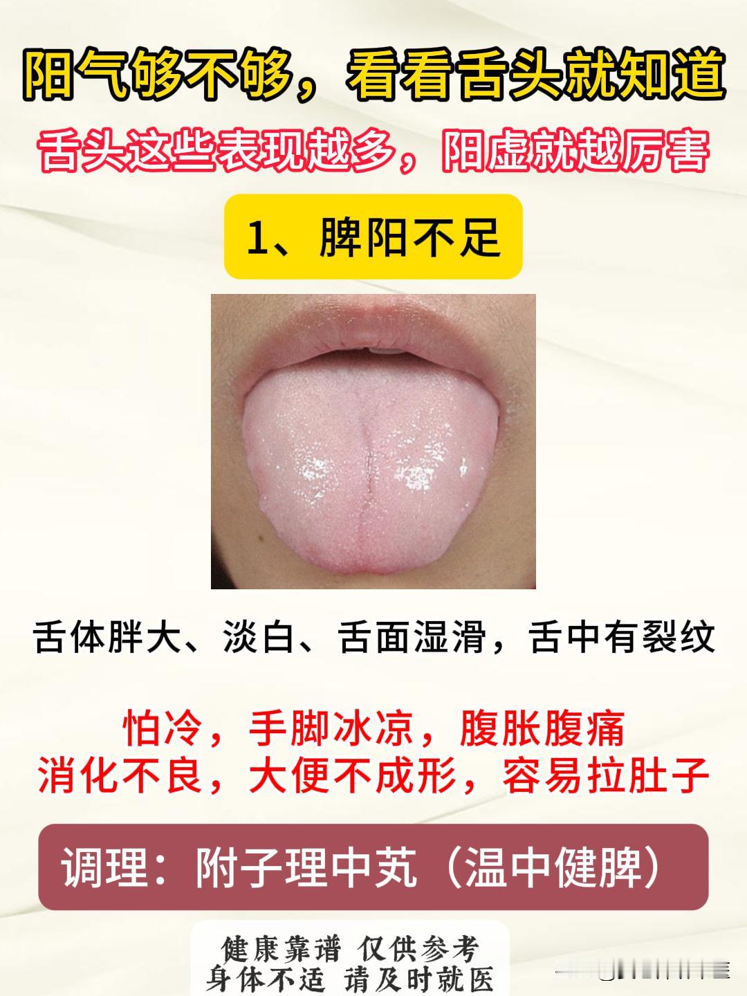 阳气够不够，看看舌头就知道，舌头这些表现越多，阳虚就越厉害！
#中医##健康##