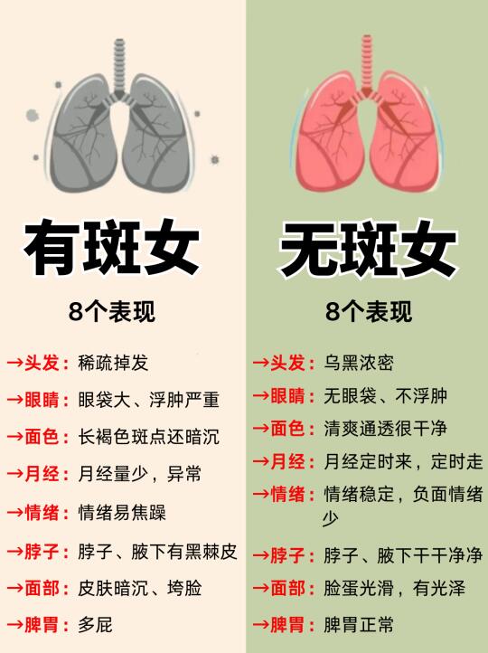 黄褐斑自测➕改善指南❗成功上岸指南来啦