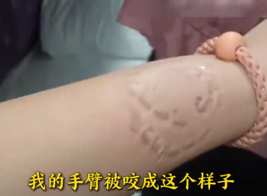 这位大妈真厉害！可能是属狗的，张嘴就胡卷乱骂，呲牙就胡乱咬人！
前不久，江苏李女