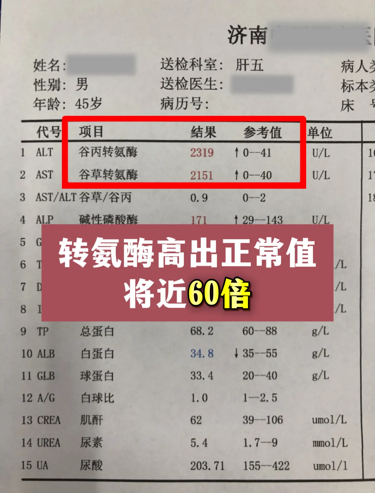 今天门诊来了一位济南本地的患者，谷丙转氨酶 2300 多，谷草转氨酶 ...