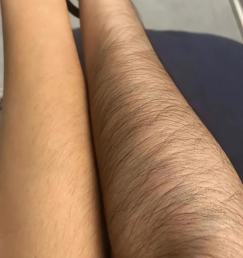 你嫌弃的那些身体特征，其实是人体悄悄装上的"精密的保护装置"。
比如体毛，现代审