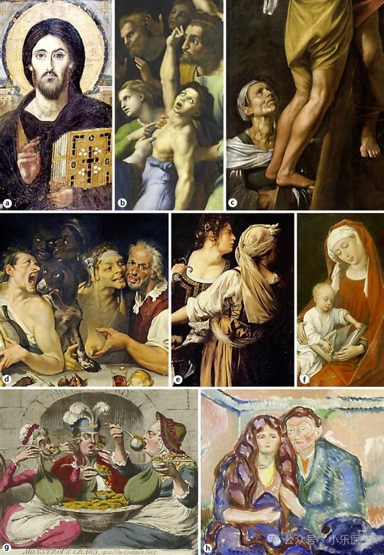 古代的人也会甲状腺肿大。这一组艺术作品最早的可以追溯到公元6世纪，最晚...