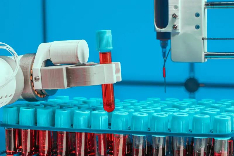 中国九O后青年女博士科学家赵锐太厉害了！她成功研发的清血检机器人，直接惊艳了医学