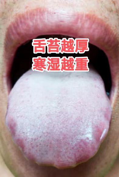 一招解决补阳上火：先藿香正气清寒湿，再附子理中温阳

先用藿香正气水清寒湿.
之