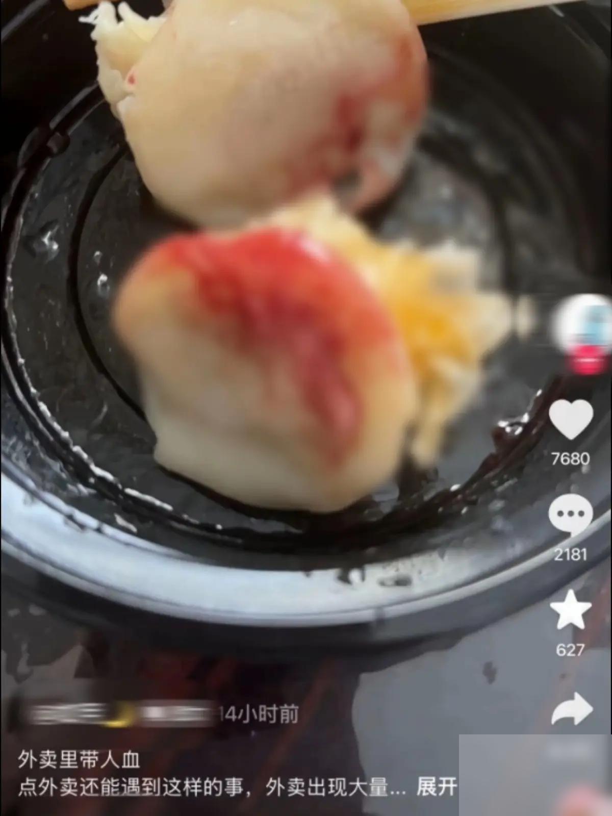 “太吓人了！”浙江杭州，一网友花22.8元点了一份烧卖外卖，吃到半截，才发现餐盒