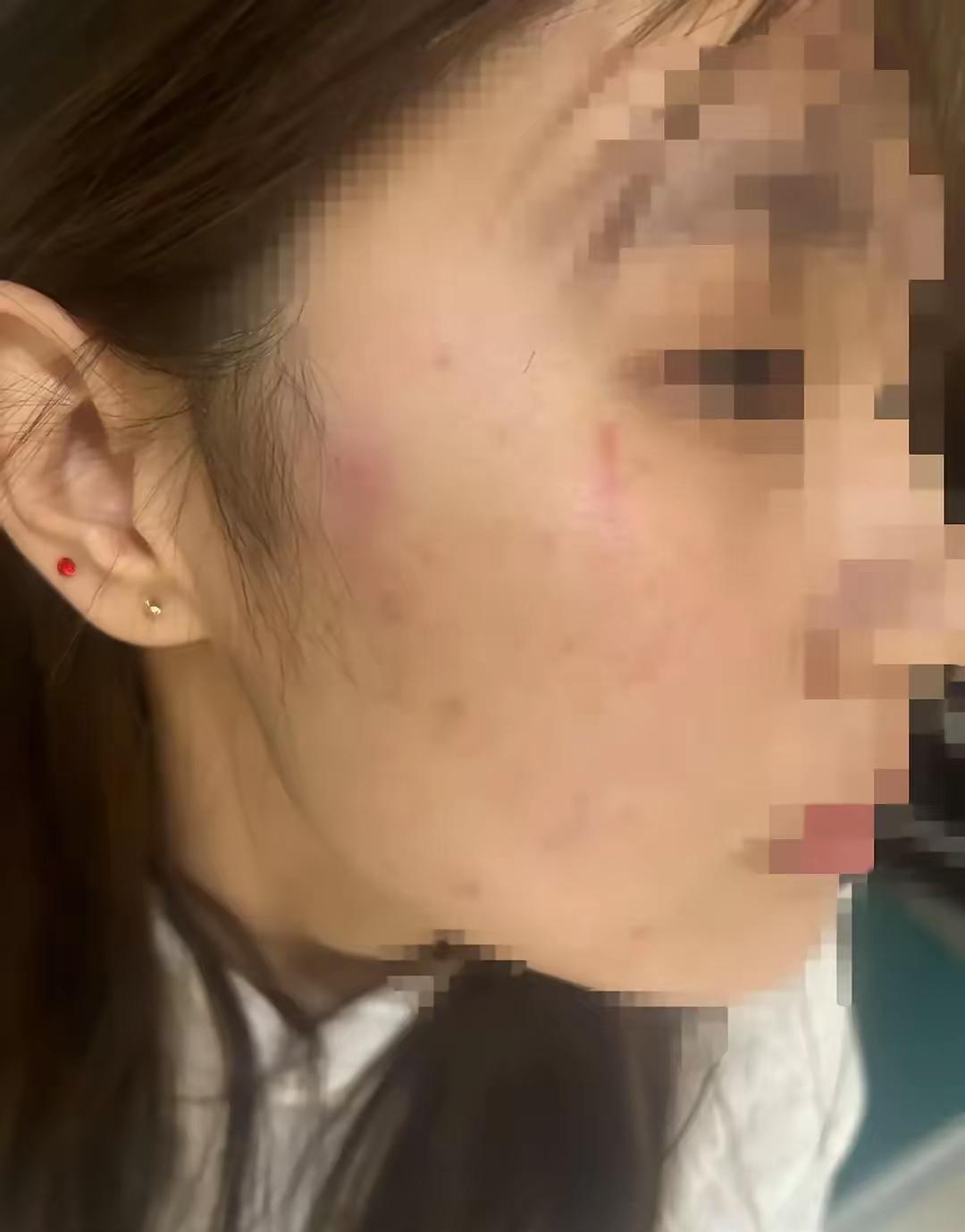 2025年2月26日晚，山东东营18岁女孩小莹独自在家时，遭遇陌生女子张某某上门