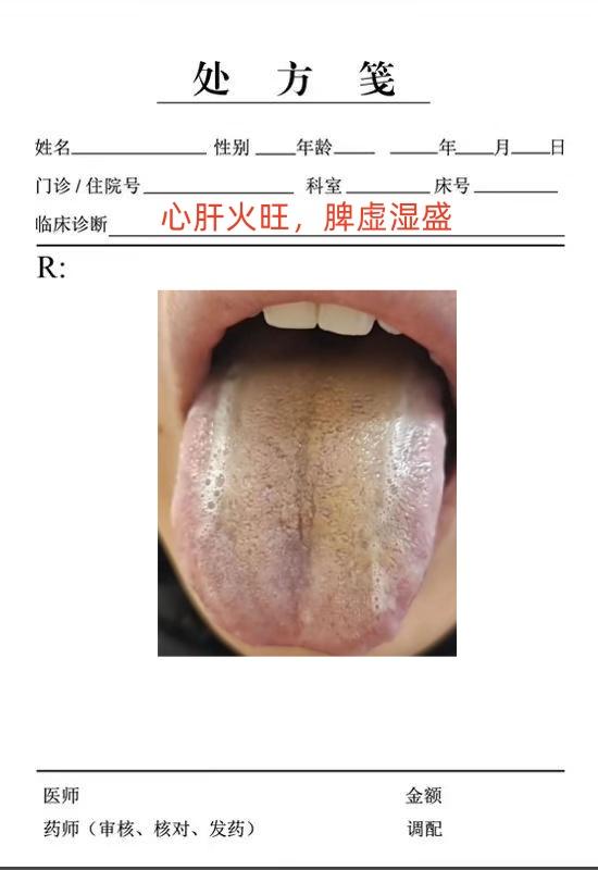 遇到这种舌象，吃再多参苓白术散也是白搭，越吃越上火。
今天接着来给大家分析舌象病