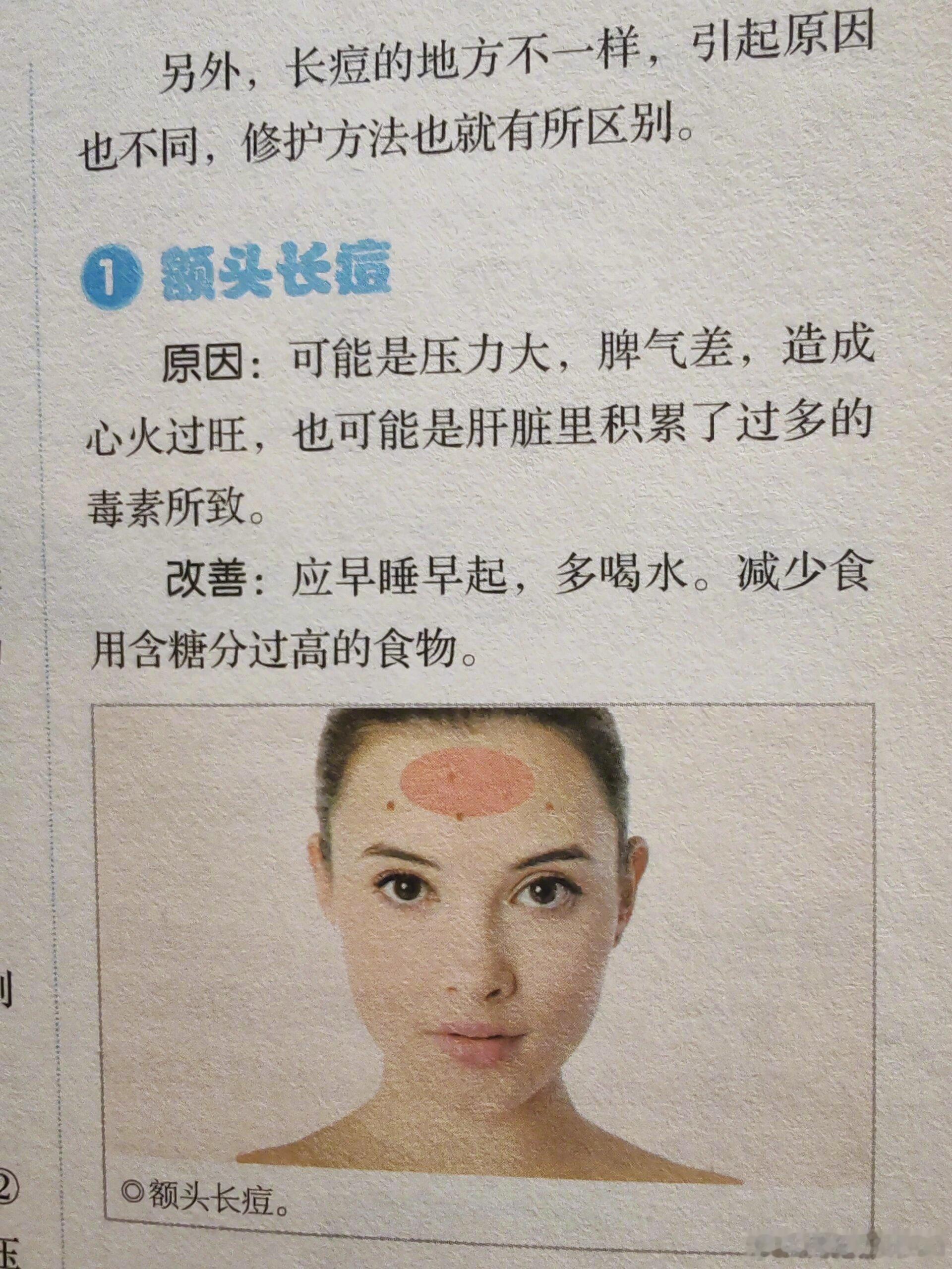 「#不同部位长痘的原因找到了#」看了《黄帝内经》才知道，原来脸上不同部位的痘痘是