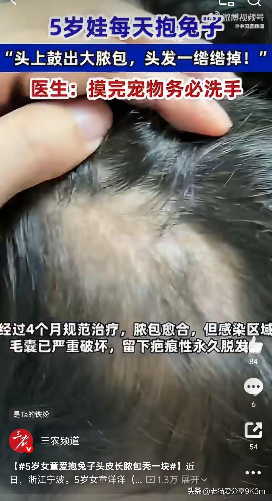 这条新闻我看得心头一紧，赶紧转给了家里有娃的亲戚。

5岁的小姑娘，喜欢小兔子，