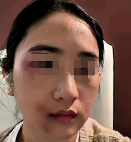 丈夫家暴妻子近十年，刚动手打完妻子三天，自己就确诊肝癌晚期，家人逼迫女方拿出全部