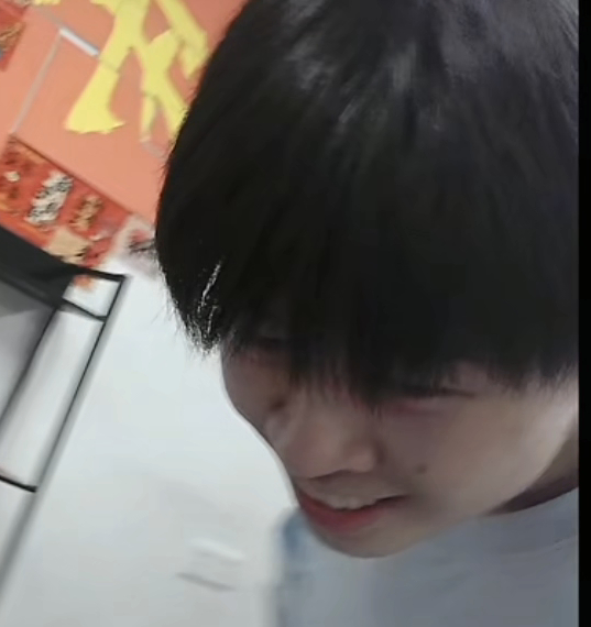脸颊肉上脸颊痣´ₒ⦁⩊⦁ₒ` 