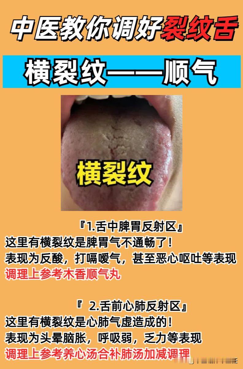 一句话教会你调好裂纹舌：横裂纹——顺气，竖裂纹——通经！

一：横裂纹——顺气