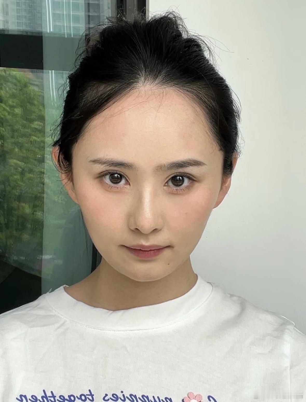 当大额头剪了刘海… ​​​