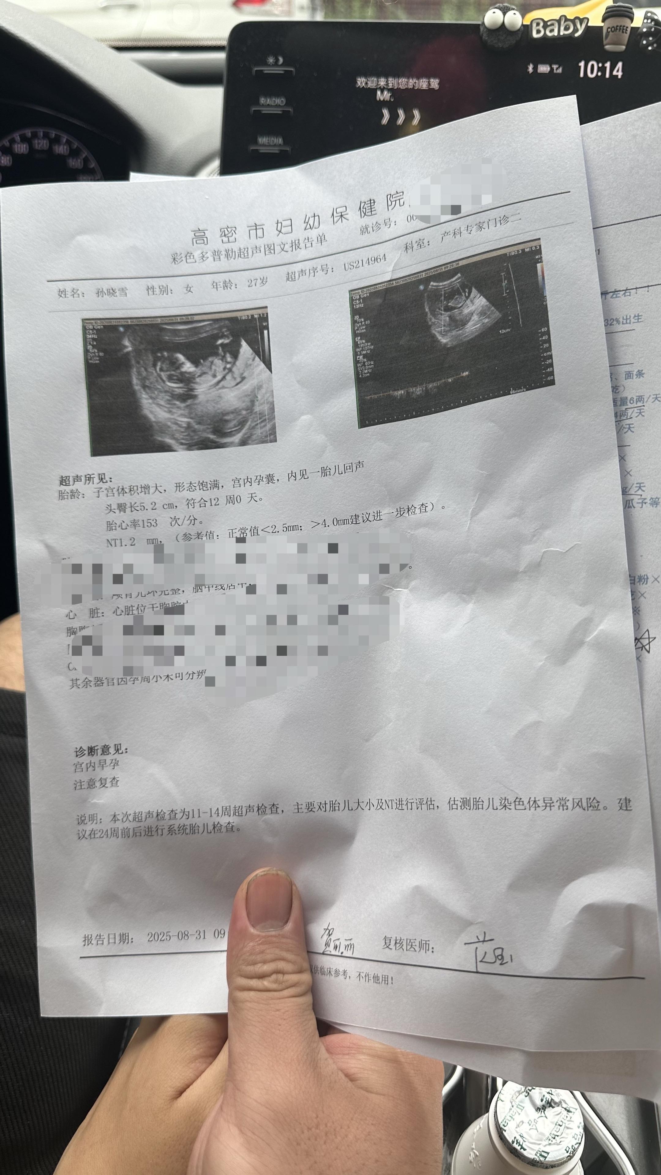 宣布你的存在了，老婆辛苦了 初见小小的模样，满心欢喜，接下来的日子里你...