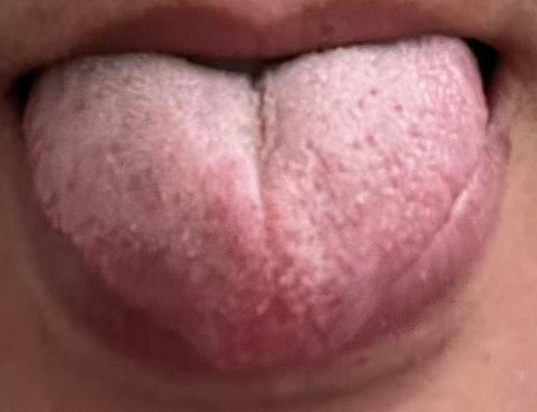 下焦状态日渐偏弱？牢记中医通透、濡养两大调理核心






最近有不少男同志问