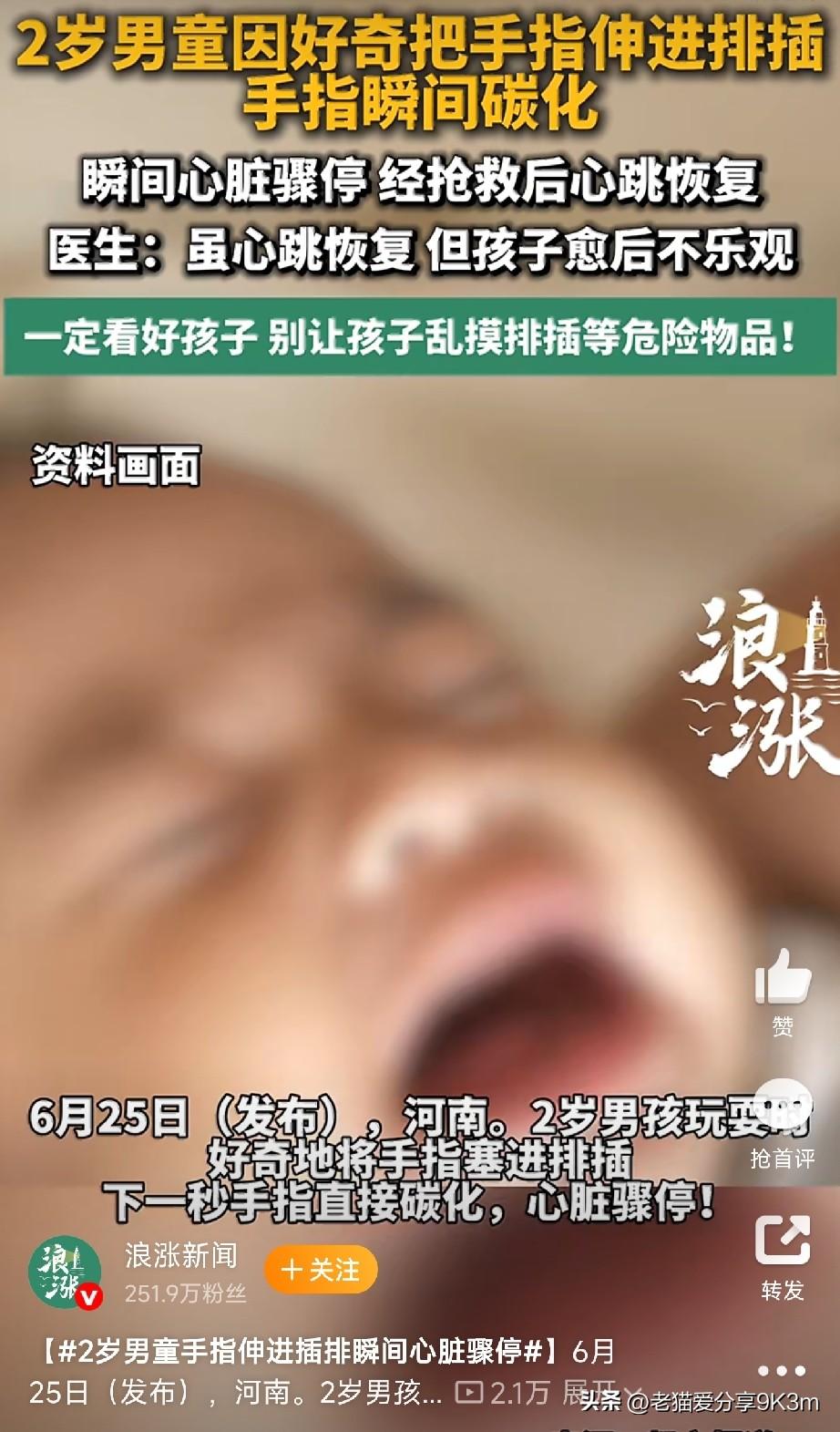 太痛心了！

河南一个2岁的小男孩，趁大人没注意，把手指头塞进了排插的插孔里。就