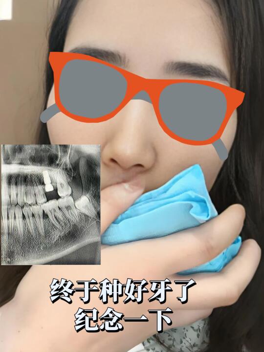 大学生种牙二期上岸，南京原三甲主任全程亲