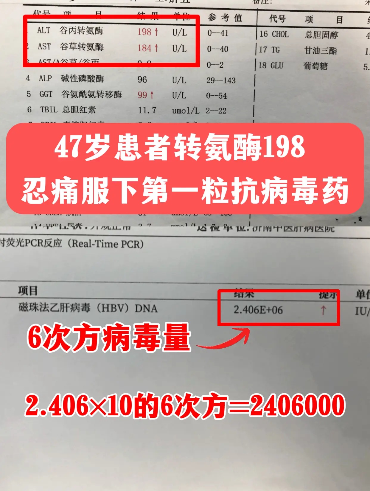 前天接诊了位济南本地的47岁患者，说最近浑身乏力、吃不下饭，一查转氨酶...