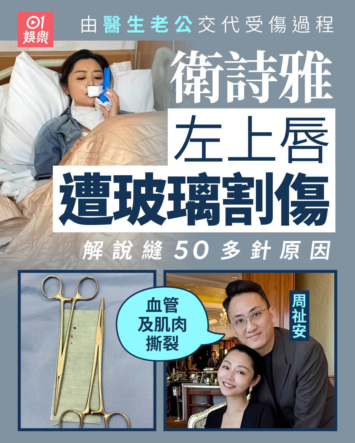 卫诗雅的丈夫在社交平台发文，代卫诗雅交代受伤过程，以及需缝50多针的原因。他表示