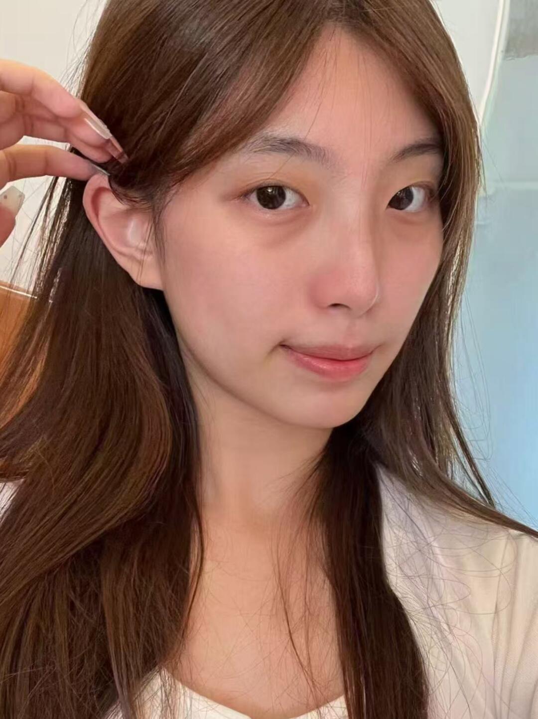 去广州做完才发现do眼袋是回春项目