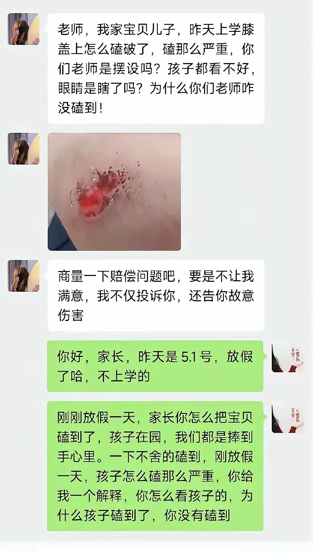 你如何看待无理取闹的家长这个老师，太不会聊天了，应该问问，赔多少，怎么赔，要是我