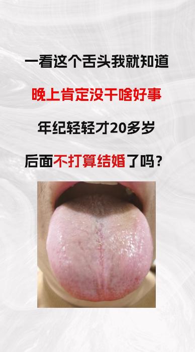 一看这个舌象，我就知道患者晚上肯定，没有干好事，年纪轻轻二十多岁，这么不节制，以