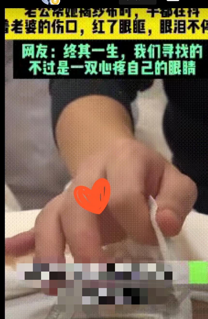 山东丈夫给妻子换剖腹产伤口，一看直接泪崩！
山东一位刚做完剖腹产的宝妈，偷偷拍下