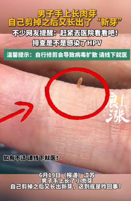 悲剧还是发生了！江苏南京，一男子手背上莫名冒出个小米粒大的肉色小疙瘩，不痛不痒但