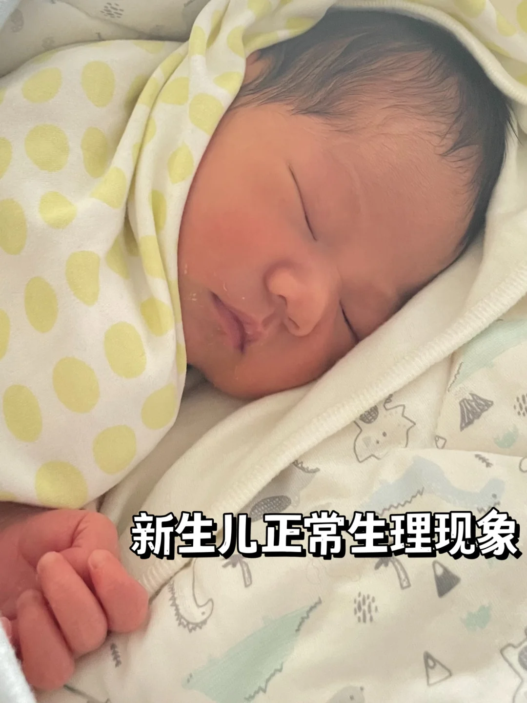 新生儿这些问题不是病 ‼️新手麻麻收藏起来！