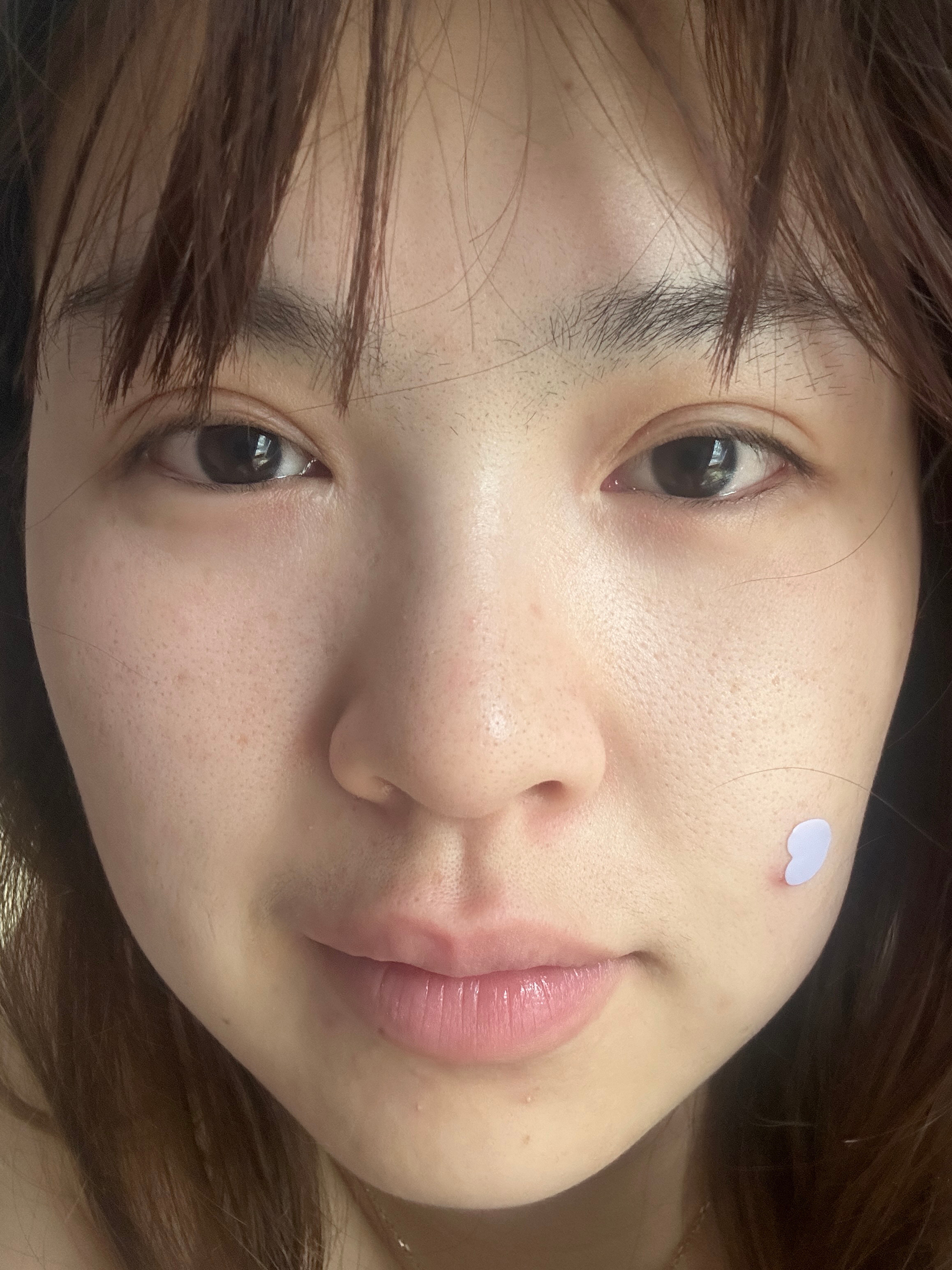 晚上吃正常饭，晚上还吃了零食还吃了两包辣条都没肿成前两天那样啊 